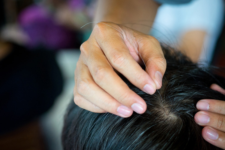 Nhổ tóc bạc là thói quen có thể gây hại đến các nang tóc