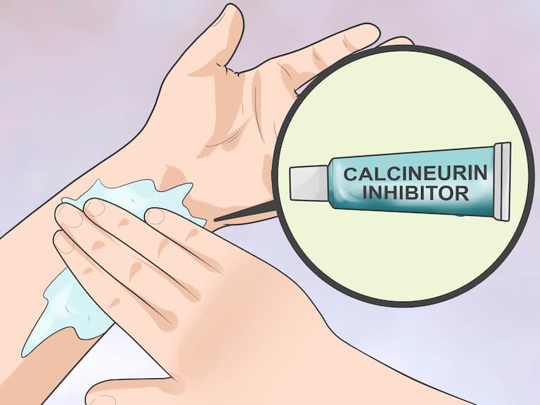Calcineurin giúp ức chế sự hình thành vi khuẩn gây viêm nhiễm