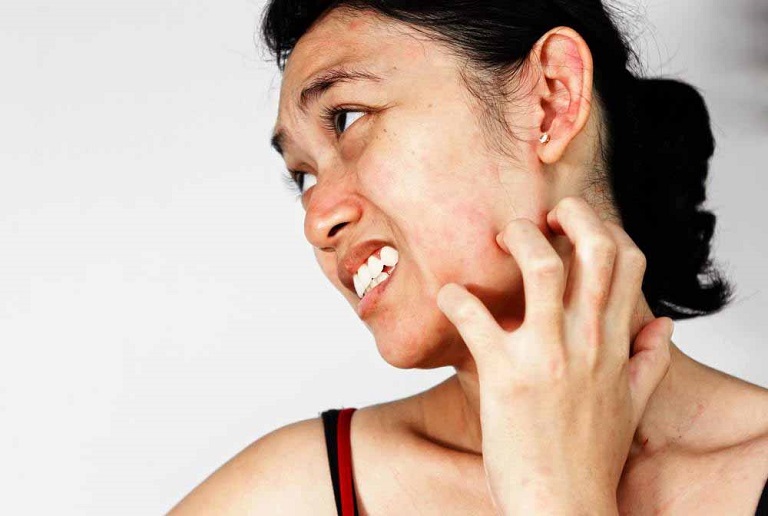 Viêm da dị ứng ở mặt là một bệnh lý gây thương tổn trên da và khởi phát tại vùng da mặt