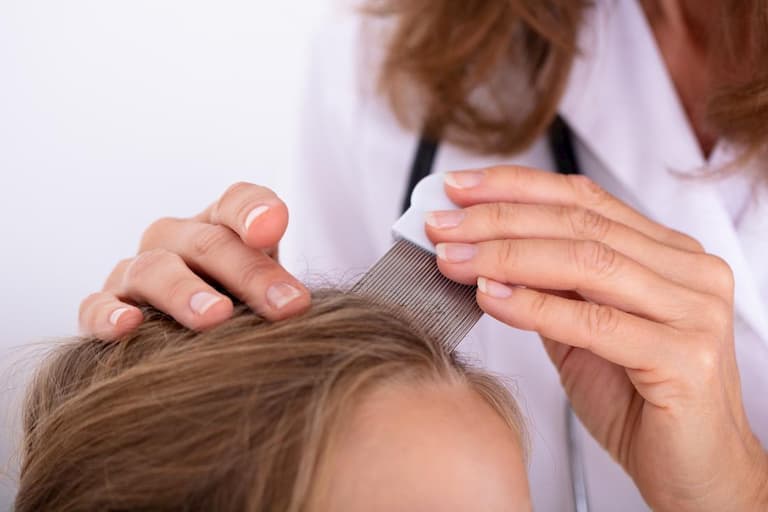 Thăm khám bác sĩ khi tóc rụng nhiều và ngứa nặng để tìm ra biện pháp khắc phục tốt nhất