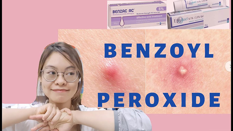 Benzoyl peroxide trị các mụn trứng cá nặng rất tốt