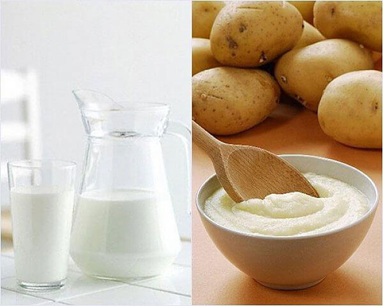 Khoai tây và sữa tươi - Mờ thâm và sáng da “siêu tốc”