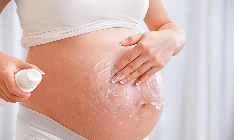 Rạn da xuất hiện nhiều nhất ở vùng bụng với phụ nữ mang thai và sau sinh