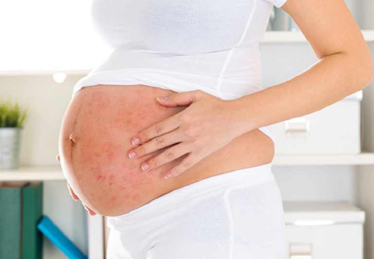 Với phụ nữ mang thai cần phải thận trọng khi dùng thuốc