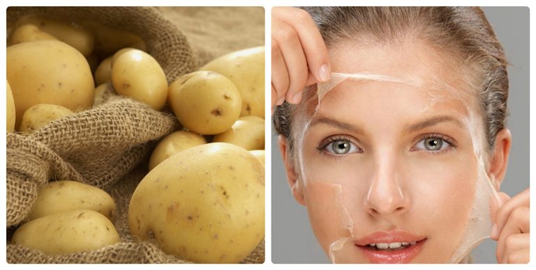 Sử dụng mặt nạ khoai tây tươi là giải pháp điều trị tàn nhang tại nhà hiệu quả.