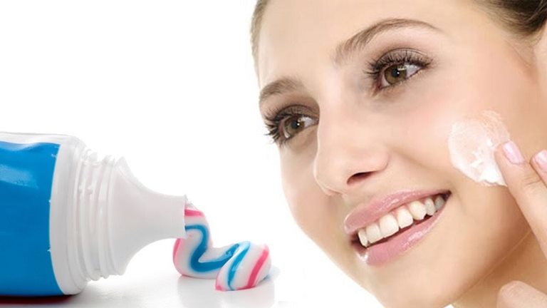 Cách trị tàn nhang bằng kem đánh răng có thể mang lại hiệu quả nếu được sử dụng đúng cách