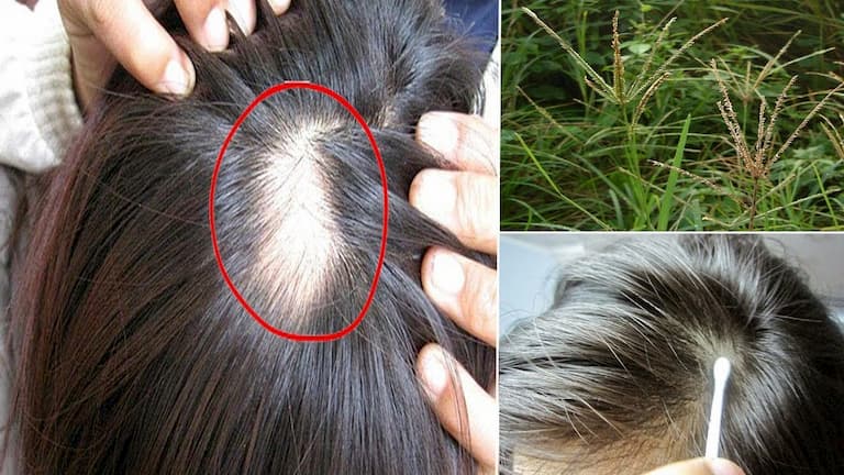 Cỏ mần trầu giúp trị rụng tóc hiệu quả