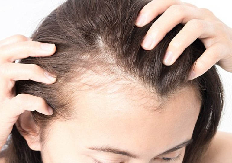 Tùy vào tính chất da đầu để lựa chọn dầu gội trị rụng tóc phù hợp