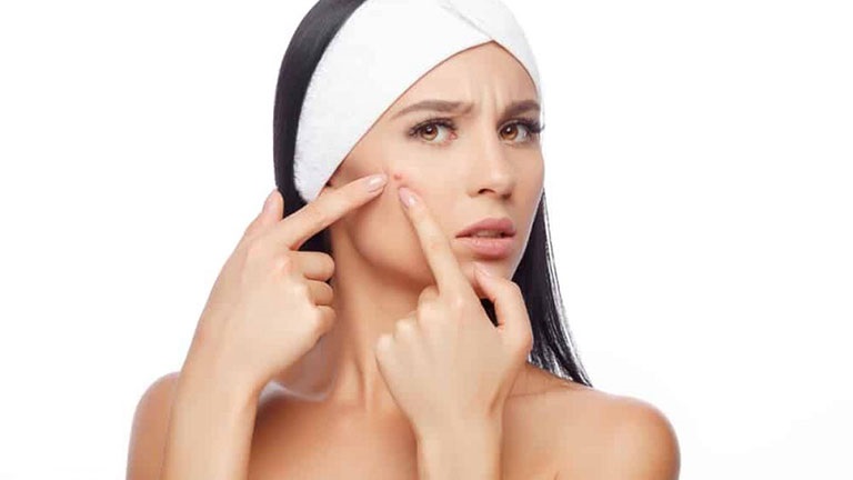 Cần giữ cho da luôn sạch, hạn chế sờ mặt khi chưa vệ sinh