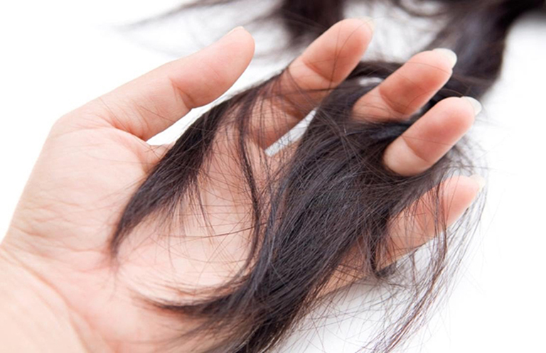 Phụ nữ bị rụng tóc sau sinh chủ yếu là do thay đổi nội tiết tố hoặc stress, căng thẳng