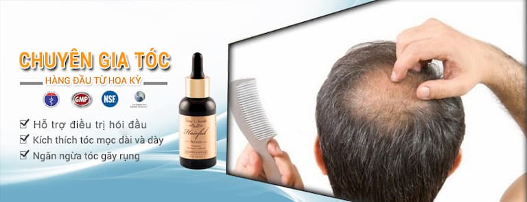 Viên uống Maxxhair  Giải pháp hỗ trợ toàn diện cho người bị rụng tóc hói  đầu