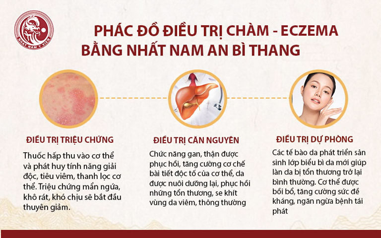 Phác đồ điều trị chàm - eczema tại Trung tâm da liễu Đông y Việt Nam