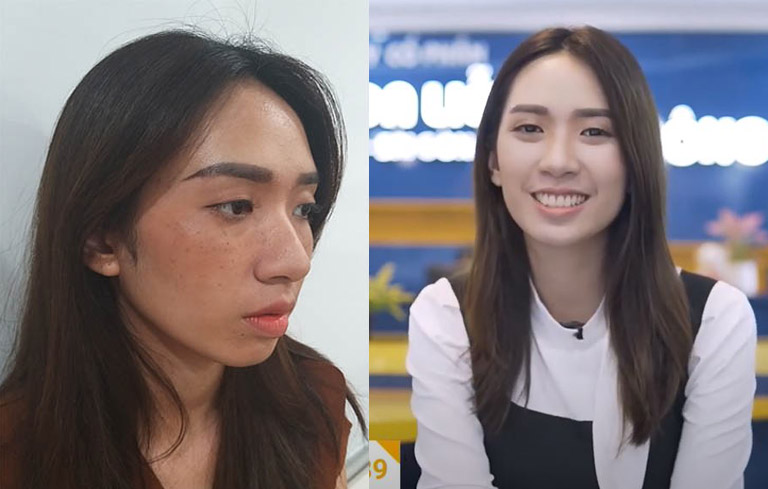 Làn da trước và sau khi dùng Vương Phi của bạn Thanh Vân