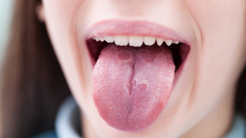 Mụn trong miệng là dấu hiệu của bệnh lý tay chân miệng